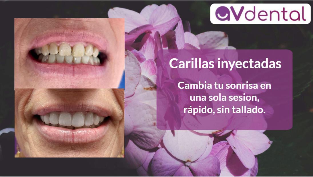 Estética Dental
